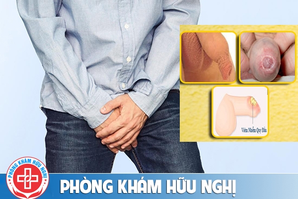 phong-kham-bao-quy-dau