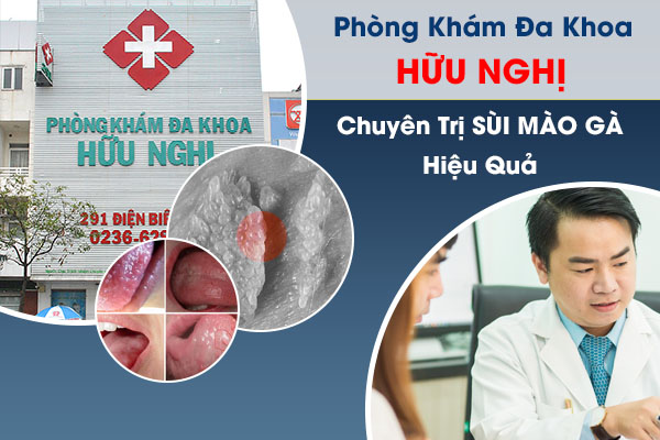 Phòng Khám Đa Khoa Quy Nhơn - Địa chỉ chữa sùi mào gà hiệu quả, hợp lý