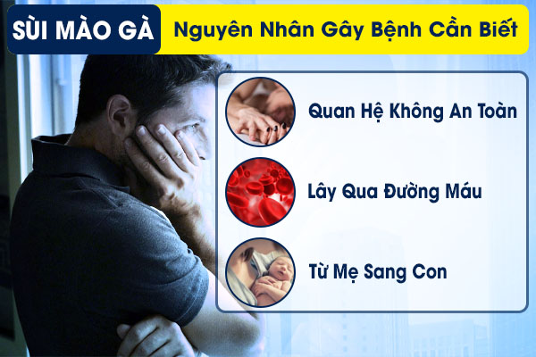 Sùi mào gà và nguyên nhân gây bệnh cần biết