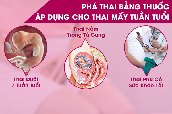 Tổng quan thông tin phá thai bằng thuốc