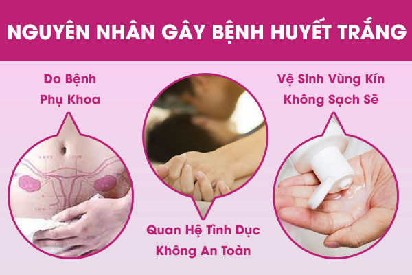 Các nguyên nhân gây ra bệnh huyết trắng
