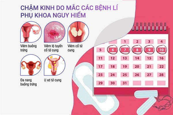 tong-quan-ve-cham-kinh-nguyet-o-nu-gioi-3