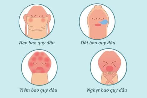 Giá cắt bao quy đầu hiện nay khoảng bao nhiêu và nên cắt ở đâu?