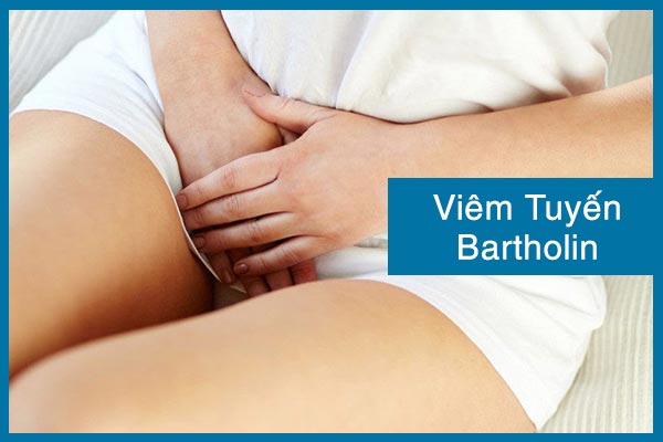 Những sự thật về viêm tuyến bartholin