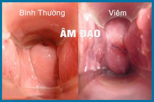 tong-hop-cach-chua-benh-phu-khoa-thuong-gap-3