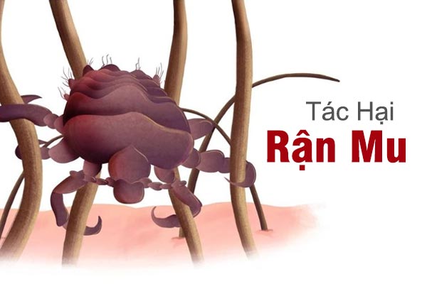 Điểm danh hàng loạt tác hại rận mu 