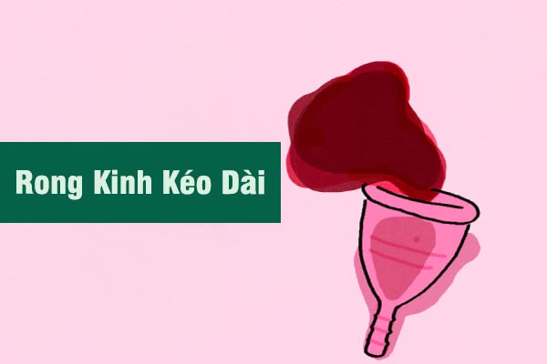 Hết sức cẩn trọng với tình trạng rong kinh kéo dài