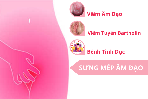 nguyen-nhan-gay-sung-mep-am-dao-va-cach-giai-quyet-02