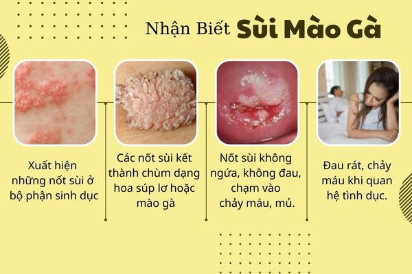 4-bien-phap-chua-sui-mao-ga-den-tu-huu-nghi-2