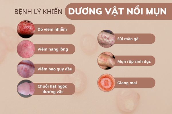 duong-vat-noi-mun-la-do-dau-va-dieu-tri-ra-sao-4