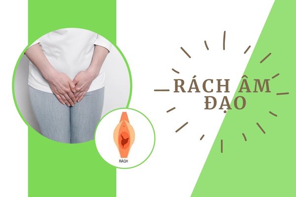 Nguyên nhân gây rách âm đạo và cách điều trị hiệu quả