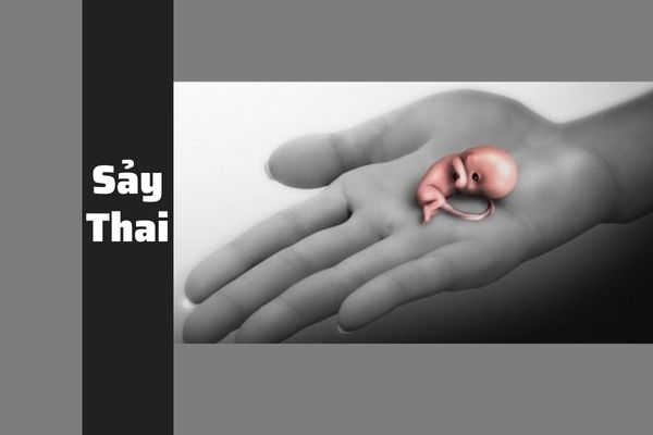 Hiểu đúng về sảy thai và cách khắc phục đúng đắn