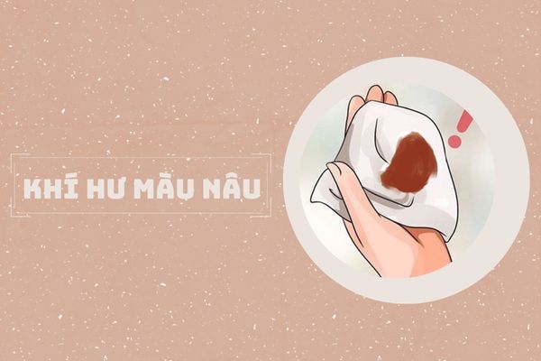 Nguyên nhân gây ra khí hư màu nâu và cách điều trị hiệu quả