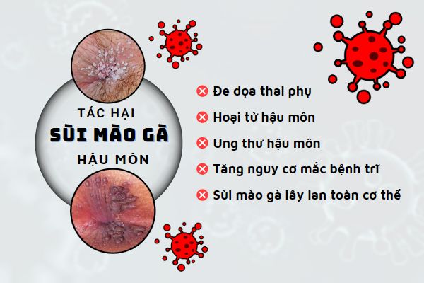 sui-mao-ga-hau-mon-nguy-hiem-khon-luong-nhung-it-ai-biet-2