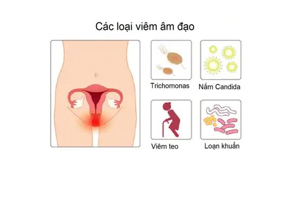 kho-rat-am-dao-xuat-phat-tu-dau-1