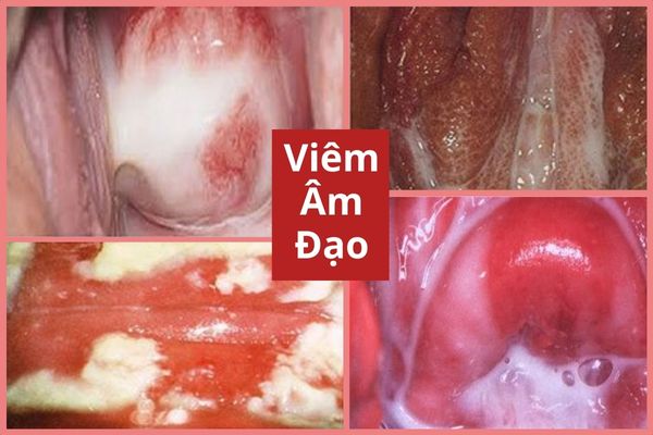 can-than-voi-tinh-trang-am-dao-bi-hoi-1