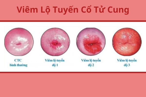 can-than-voi-tinh-trang-am-dao-bi-hoi-2