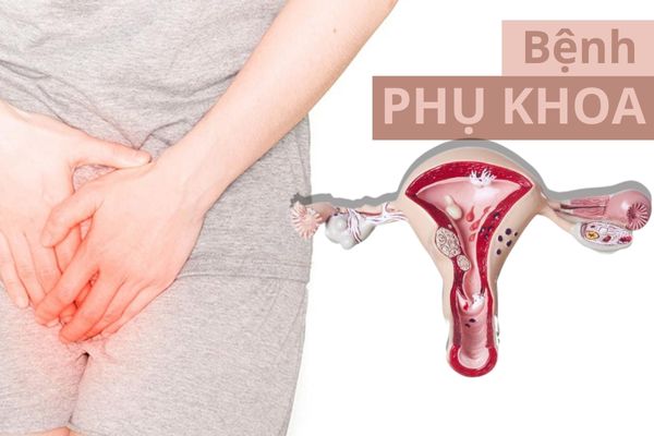 Cảnh giác với bệnh phụ khoa và lời khuyên về sức khỏe