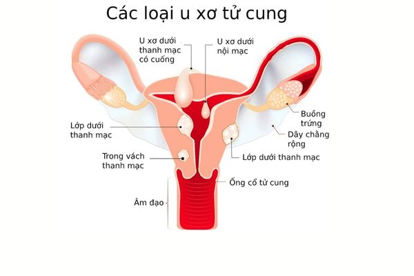 canh-giac-voi-benh-phu-khoa-va-loi-khuyen-ve-suc-khoe-8