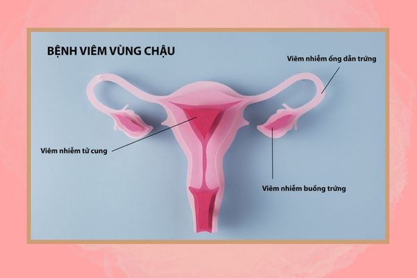 dau-rat-vung-kin-la-benh-gi-va-tri-the-nao-moi-het-2