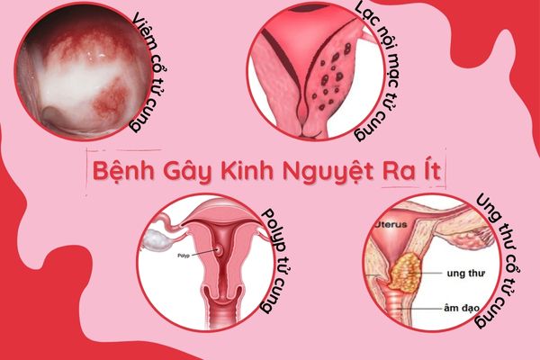 kinh-nguyet-ra-it-la-do-dau-va-khac-phuc-nhu-the-nao-1