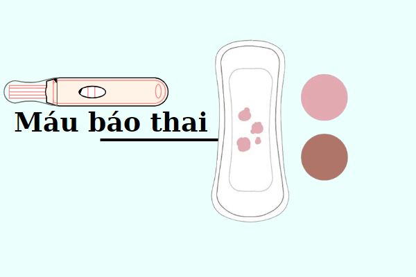 Nhận diện máu báo thai chính xác nhất