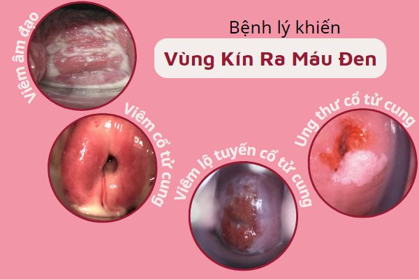 vung-kin-ra-mau-den-canh-bao-dieu-gi-va-phai-lam-sao-1