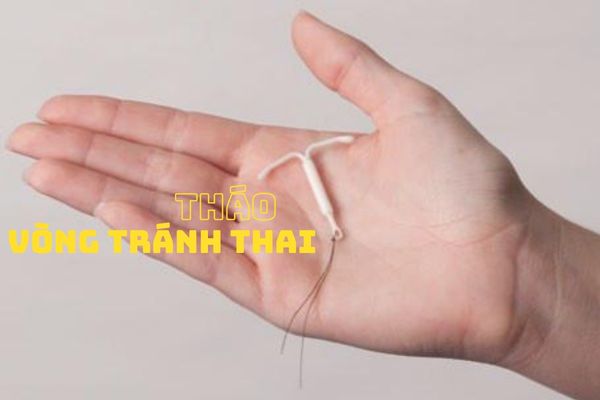 Khi tháo vòng tránh thai cần lưu ý điều gì?