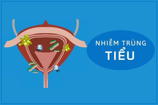 Nhiễm trùng tiểu có nguy hiểm không và khắc phục thế nào?