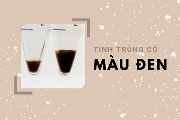 tinh-dich-co-mau-khac-thuong-canh-bao-dieu-gi-3