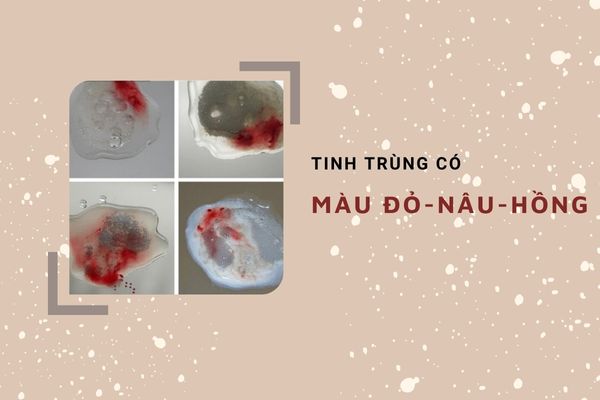 tinh-dich-co-mau-khac-thuong-canh-bao-dieu-gi-4