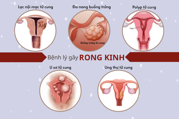 chua-benh-rong-kinh-nhu-the-nao-hieu-qua-2
