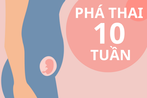 Có nên tiến hành phá thai 10 tuần?