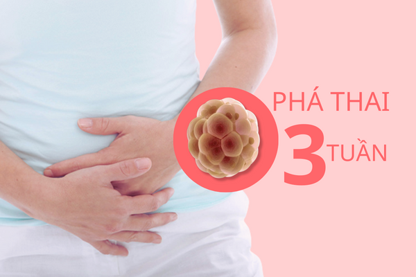 Điều cần lưu ý khi quyết định phá thai 3 tuần