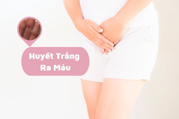 Huyết trắng ra máu cảnh báo điều gì?