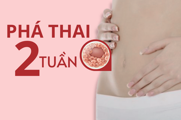 Làm sao để phá thai 2 tuần an toàn?