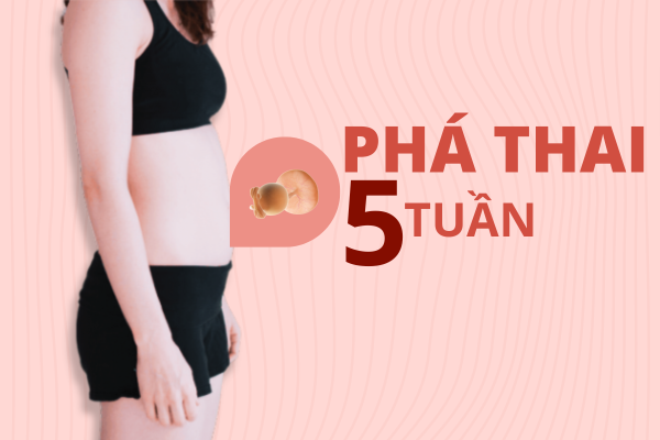 Những vấn đề nên biết khi phá thai 5 tuần