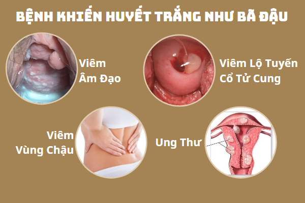 tai-sao-gap-phai-huyet-trang-nhu-ba-dau-1