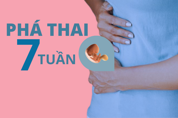 Thông tin cần biết khi phá thai 7 tuần