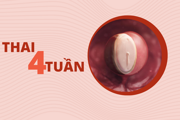 thuc-hien-pha-thai-4-tuan-an-toan-nhu-the-nao-1