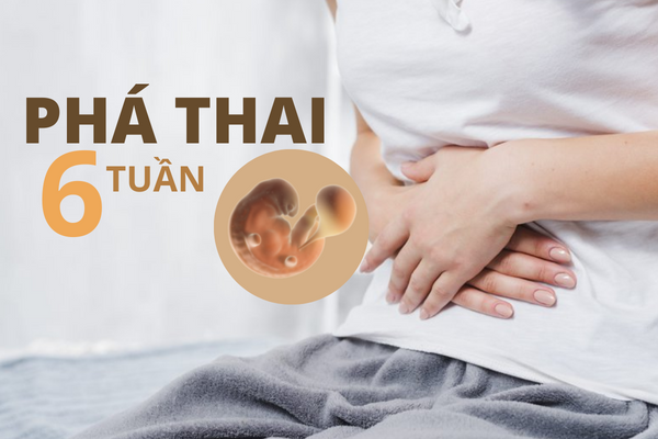 Thực hiện phá thai 6 tuần được không?