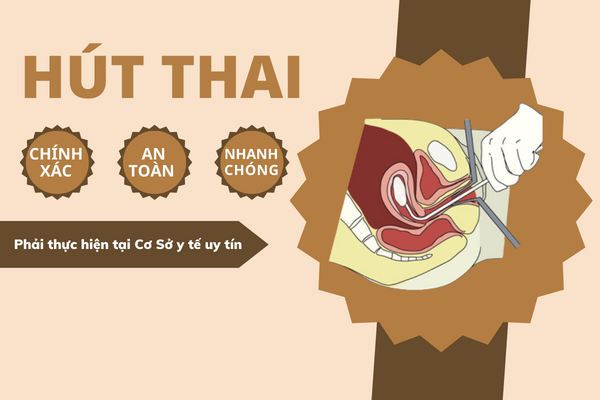 thuc-hien-pha-thai-6-tuan-duoc-khong-3
