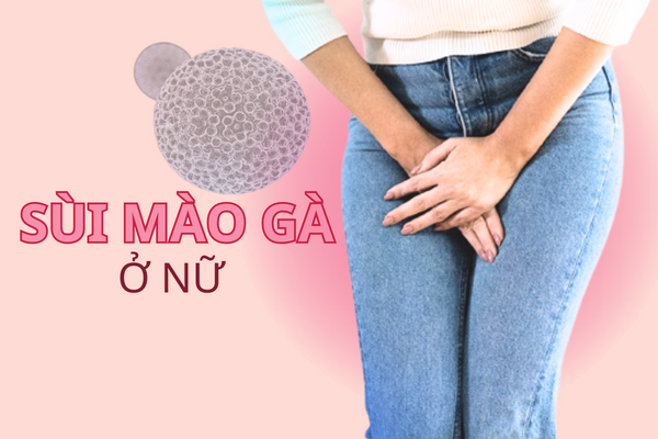 Báo động “Đỏ” về sùi mào gà ở nữ