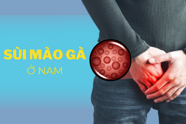 Cảnh báo bệnh sùi mào gà ở nam giới