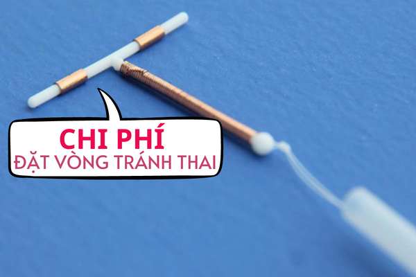 Chi phí đặt vòng tránh thai là bao nhiêu?