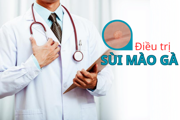 Điều trị sùi mào gà hiệu quả không khó tại Quy Nhơn