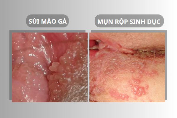 dung-chu-quan-khi-bi-noi-mun-o-am-dao-1