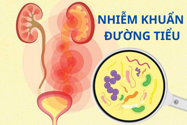 Nhiễm khuẩn đường tiểu là gì và điều trị ra sao?
