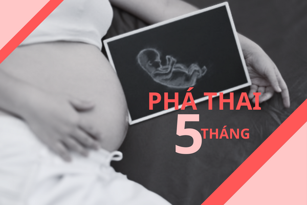 Những điều cần lưu ý khi phá thai 5 tháng
