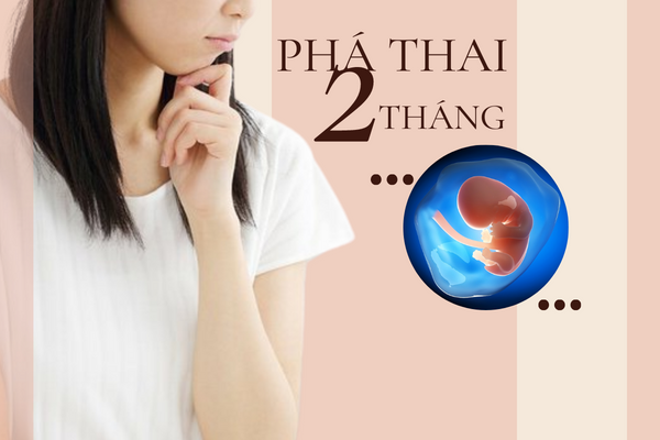 Phá thai 2 tháng có được không? cách nào an toàn?